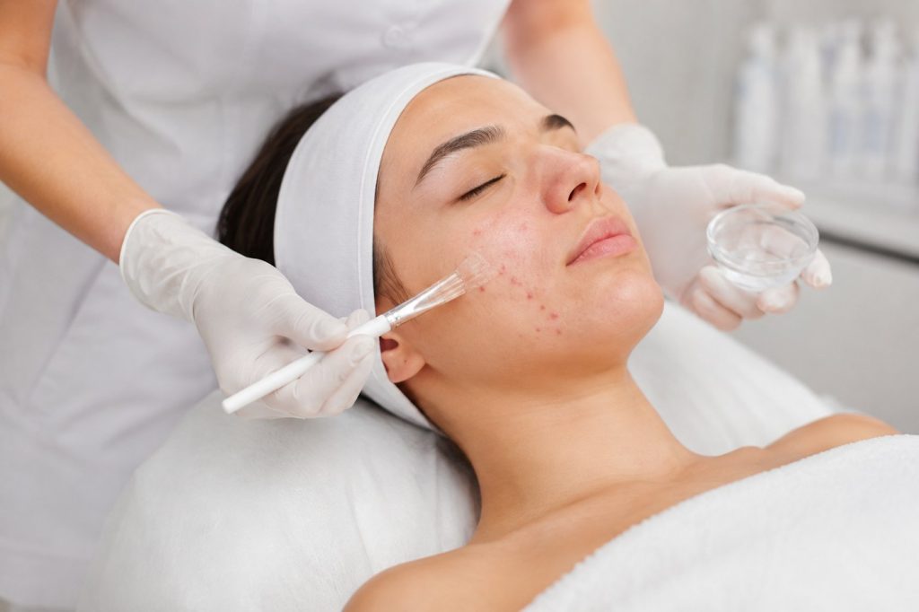 acne behandeling masker