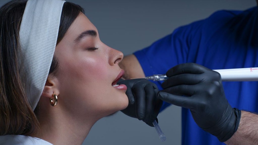 Lipfillers