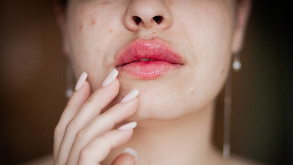 Wanneer naar de dermatoloog gaan