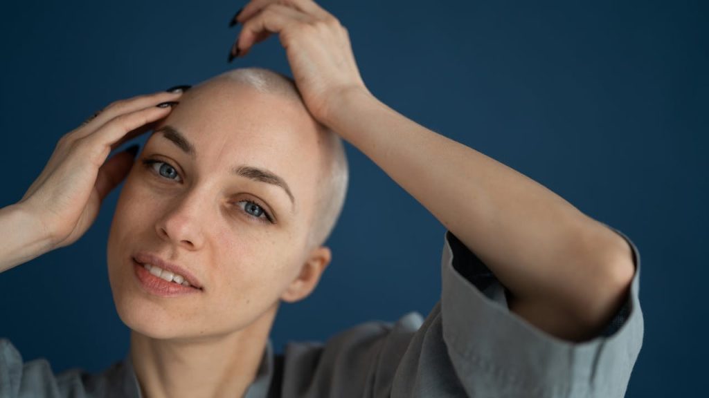 De oorzaken van haarverlies van vrouwen